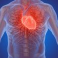 La crise cardiaque ou Infarctus du myocarde (IDM) est une urgence médicale due à la destruction plus ou moins étendue du muscle du cœur. Au Burkina Faso, elle a une […]